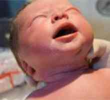 Obstrucția canalului lacrimal la nou-nascuti