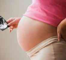 Placentation scăzut în timpul sarcinii: cauze, impact și recomandări