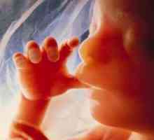 Normele indicele amniotic sarcinii, patologia lichidului amniotic