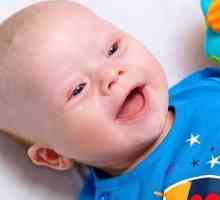 Bebelușii cu sindromul Down