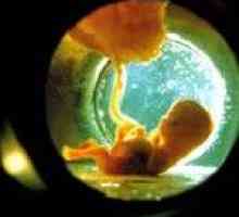Lichid amniotic in timpul sarcinii: valoarea. Scurgerea și ruperea prematură a membranelor: cauze,…
