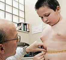 Obezitatea la copii este de mai multe ori crește riscul de litiază biliară (GSD)