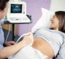 Prima ecografie în timpul sarcinii
