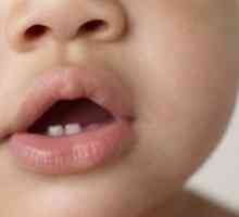 Primii dinți la sugari: simptome și semne de erupție