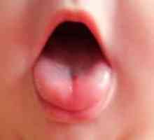 Petele de pe limba copilului