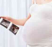 Fructul unei gravide de 26 de săptămâni