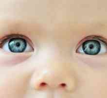 De ce supurează ochii copilului?