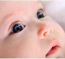 De ce supurează ochii unui copil nou-născut?