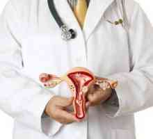 Polip canalului cervical în timpul sarcinii