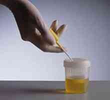 Condiții de colectare a urinei pentru analize