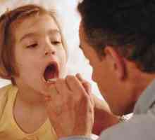 Tratamentul adecvat al gâtului la copii cu vârsta de 2 până la 5 ani