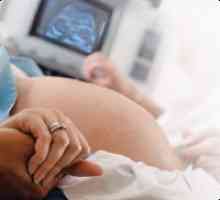 Diagnosticul prenatal de fetale