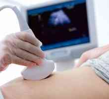 Screening-ul prenatal
