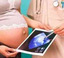 Cauzele și consecințele nașterii întârziere