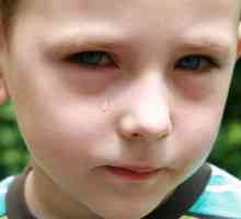 Cauzele pungile de sub ochii copilului și eliminarea acestora