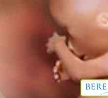 Motivele pentru dezvoltarea sarcinii