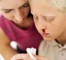 Cauzele sângerări nazale la copii
