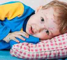 Semne de scarlatină la copii, tratamentul și prevenirea