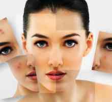 Problema pielii: 7 concepții greșite populare despre acnee