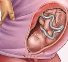 Amplasarea fătului în timpul sarcinii