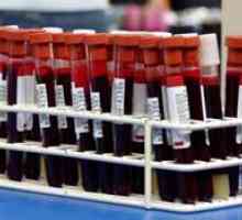 Decodarea testelor de sânge la copii