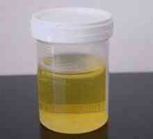 Descifrarea analiza urinei la copii
