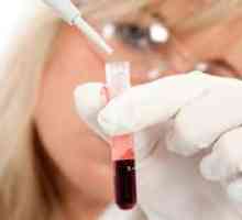 Descifrarea analiza generală a sângelui