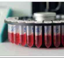 Descifrarea rezultatele testelor de sânge la copii