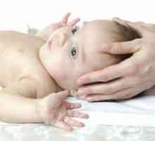 Speciile și efectele echimoze asupra capului nou-născutului