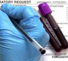 Test de sânge rw
