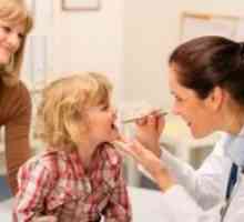 Simptomele de difterie la copii