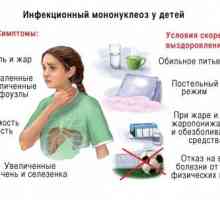 Simptomele de mononucleoza infecțioasă în copil și tratamentul său