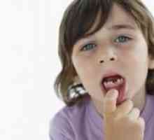 Schimbarea dintilor primare la copii