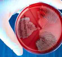 Streptococcus în timpul sarcinii