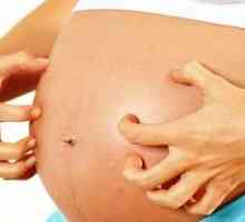 Erupții cutanate în timpul sarcinii: cauze posibile
