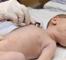 Prejudiciu neonatală