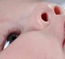 Un nou-născut supurează ochii