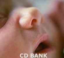 Un nou-născut supurează ochii
