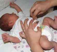 Îngrijirea nou-născut buric