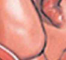 Ce se schimbă colul uterin înainte de travaliu