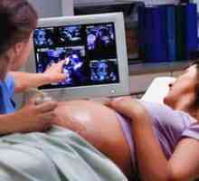 Importanța utilizării ultrasunete în timpul sarcinii