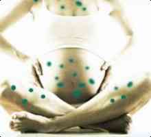 Varicela in timpul sarcinii