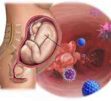 Infecție intrauterină în timpul sarcinii și nou-născut