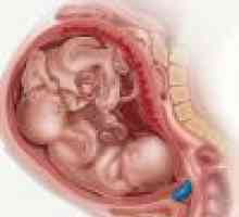 Boli în timpul sarcinii