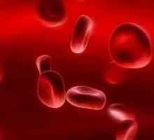 Deficitul de fier anemiei la copii