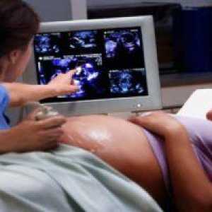 34 De săptămâni de sarcină: fetale Greutate