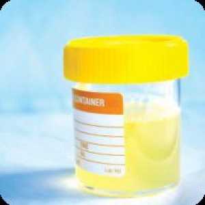 Acetona în urină în timpul sarcinii