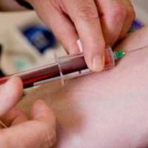 Un test de sange pentru hepatita