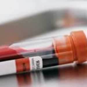 Un test de sange pentru hormoni