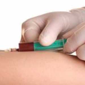 Testul de sânge pentru hCG: întrebări și răspunsuri